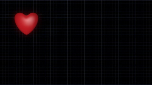 ECG trace