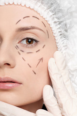 Obraz na płótnie Canvas Correction lines on woman face, before surgery operetion