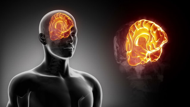 Detailed view - Male BRAIN LEFT CEREBRUM in x-ray