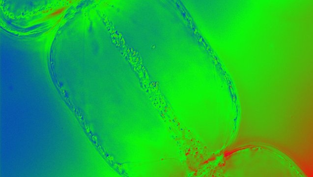 Cytoplasmic streaming