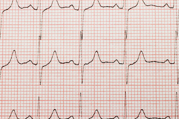 Cardiogram close-up