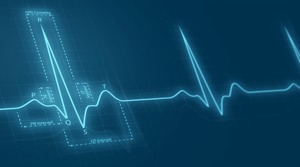 cardiogram