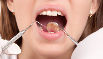dental treatment at the dentist