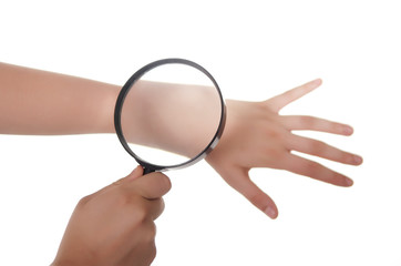 Hand, Lupe und Haut