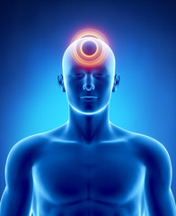 Fototapeta premium Migraine and headache concept