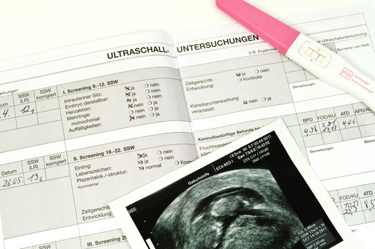 Mutterpass mit Ultraschallbild und Schwangerschaftstext