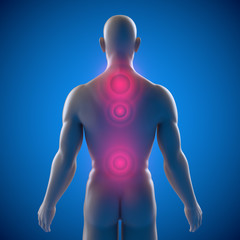 Männlicher Oberkörper – Rückenschmerzen