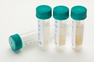 saliva samples for laboratory test - obrazy, fototapety, plakaty