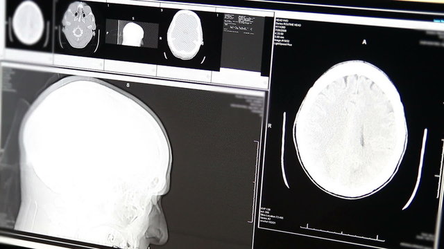 Brain Scan Display
