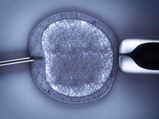 artificial insemination - obrazy, fototapety, plakaty