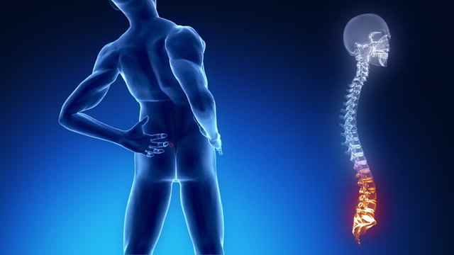 Backache in x-ray view with spine datail