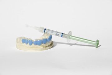 Calco in gesso, mascherina, gel sbiancamento denti