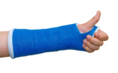 Armgebrochen, alles Ok
