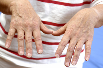 femme douleur rhumatisme