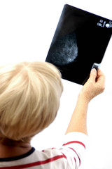 femme mammographie