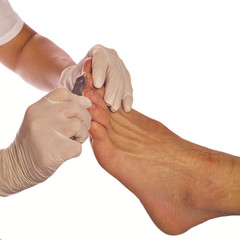 podologische Nagelbehandlung quadratisch