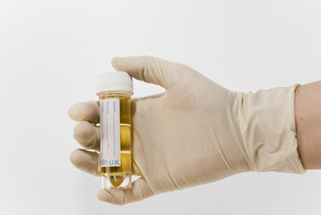Gloved Hand Holding Urine Sample in Medical Jar