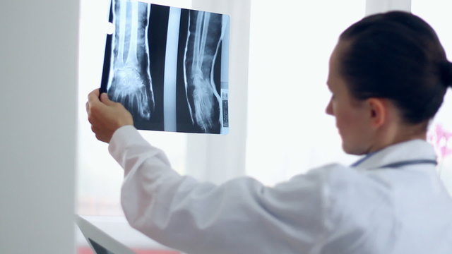 Female doctor looking at xray of human hand
