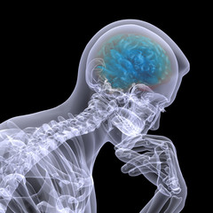 Skeleton X-Ray - Thinker