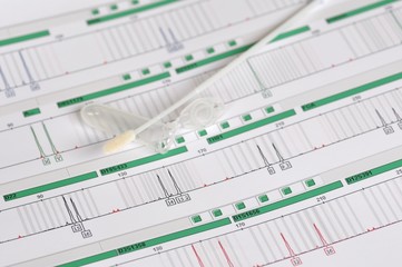 DNA Profil - genetischer Fingerabdruck