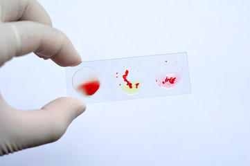 Blood group testing