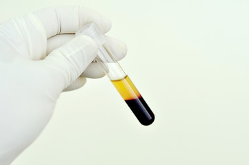 Blood sample