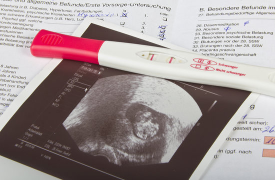 Ultraschallbild Schwangerschaftstest Mutterpass