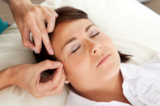 Acupuncture Therapist Placing Needle in Face