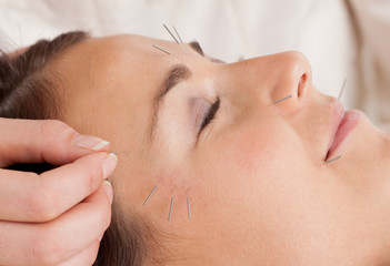 Facial Acupuncture Treatment Detail