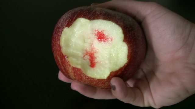 Sensitive bleeding gums and dental problems
