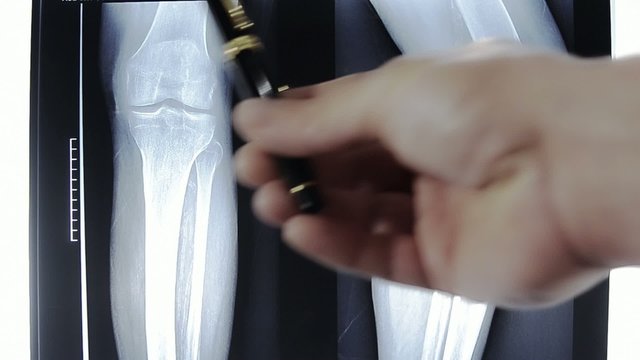 radiografia degli arti inferiori