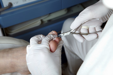 Medizinische Fußpflege - Foot care - Chiropody