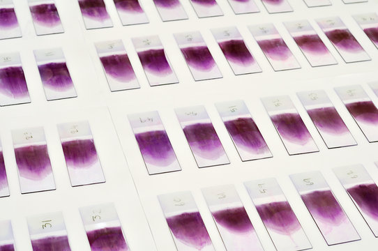 Blood film