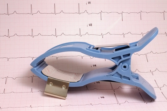 Limb ECG electrode with ECG record on paper in background