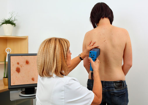 medical examination of birthmark