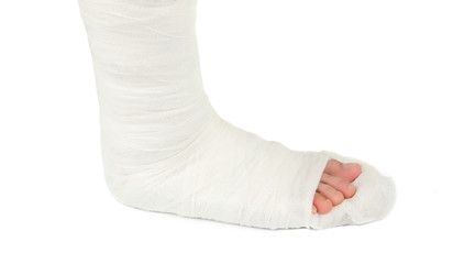 leg in a plaster cast