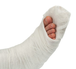 leg in a plaster cast
