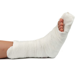 leg in a plaster cast