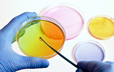 hand of a technician inoculating plates