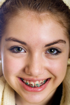 Teenaged girl with mouth full of braces