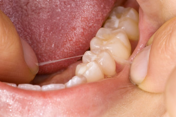 Mundhygiene