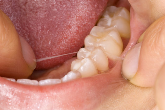 Mundhygiene
