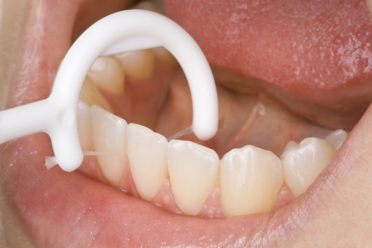 Mundhygiene