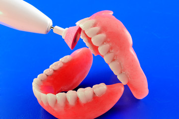 Refinement of dental prostheses