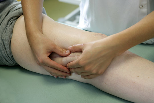 Kin&eacute; - Massage cicatrice