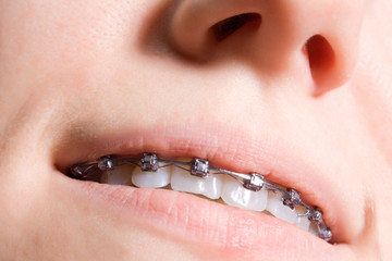 teeth