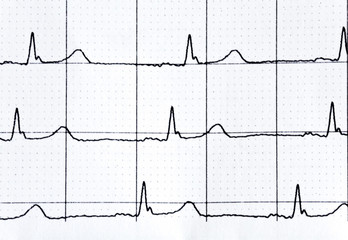 Naklejka premium heart rate in graph on a paper from the medical device