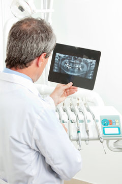 Zahnarzt analysiert Röntgenbild
