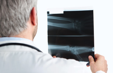 Doctor checking a wrist x ray isolated on white