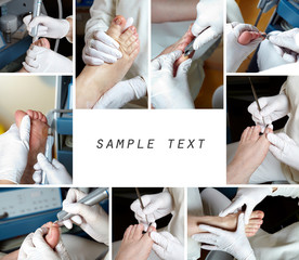 Medizinische Fußpflege -Collage - obrazy, fototapety, plakaty